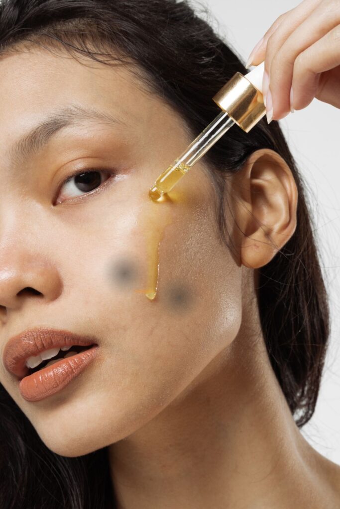 O Melasma esta atrapalhando sua vida social (8)