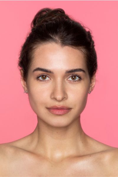 rosto mulher melasma mancha no rosto